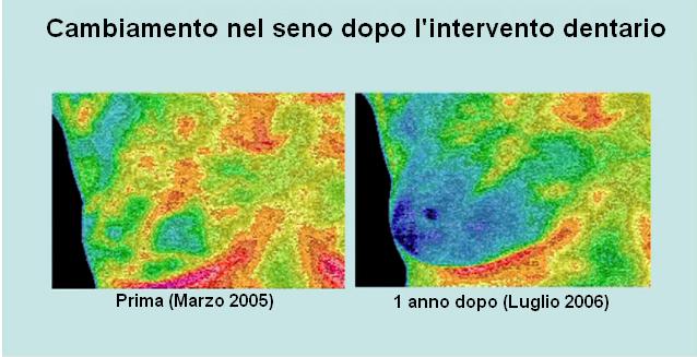 termografia 11