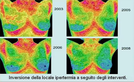 termografia 3