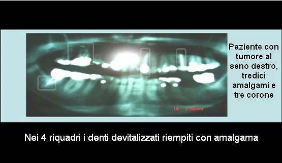 termografia 5