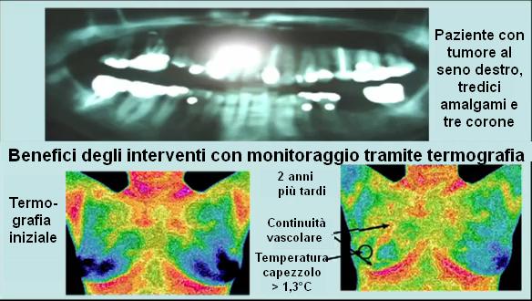 termografia 6